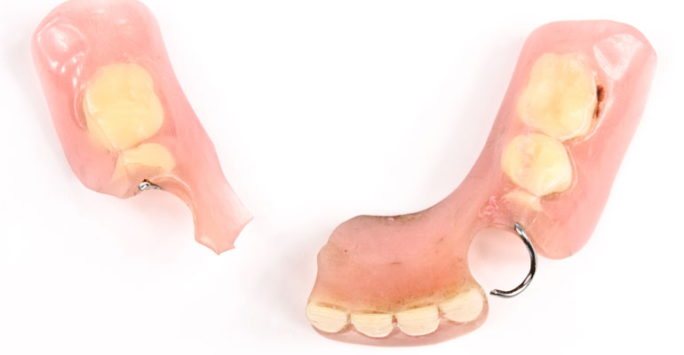 Broken Dentures