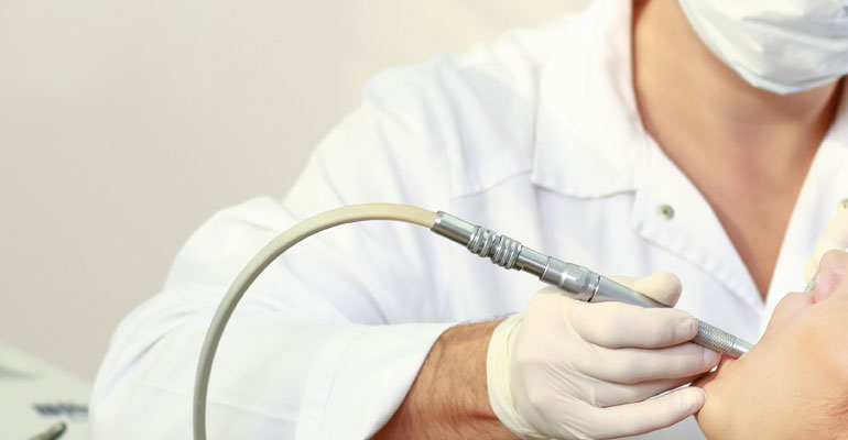 Root Canal